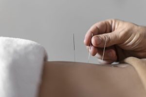 Can acupuncture really balance your QI and improve your health?